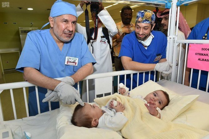 A 35-member medical and surgical team began the operation to separate conjoined twins Ahmed and Mohammed in the morning. (SPA)