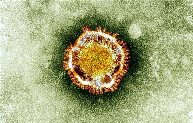 This undated handout picture courtesy of the British Health Protection Agency shows the Coronavirus as seen under an electron miscroscope. (AFP)