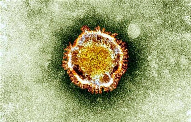 This undated handout picture courtesy of the British Health Protection Agency shows the coronavirus as seen under an electron miscroscope. (AFP/file)