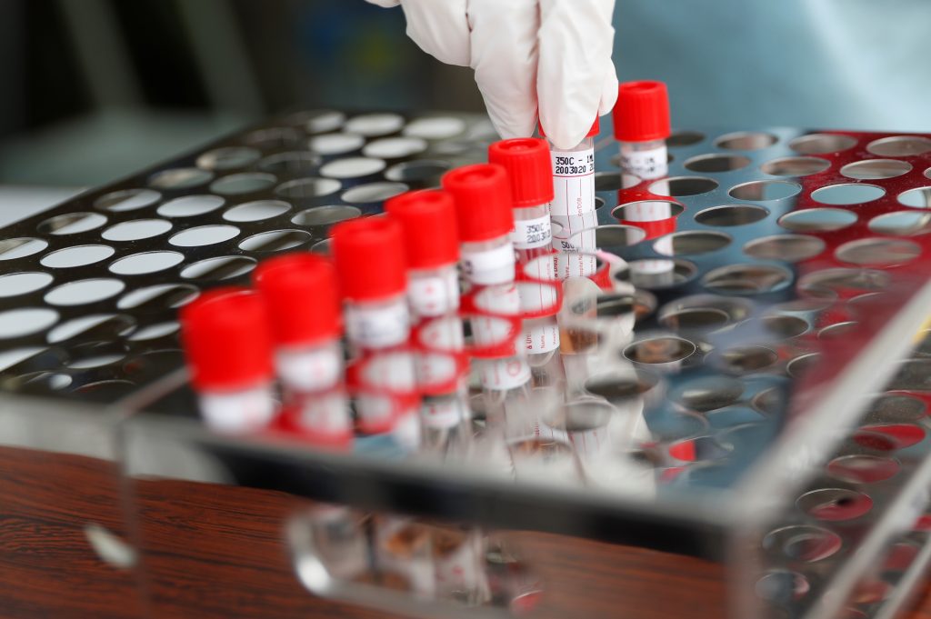 Japan's health ministry to conduct antibody tests to investigate the extent of the spread of the novel coronavirus. (File photo/Reuters) 