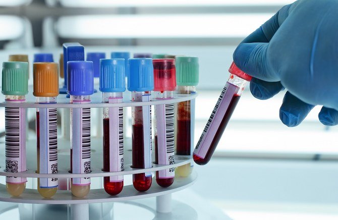 The treatment takes antibody-rich plasma from recovered coronavirus patients and injected into people who have severe cases of COVID-19, the disease caused by the virus. (Shutterstock)