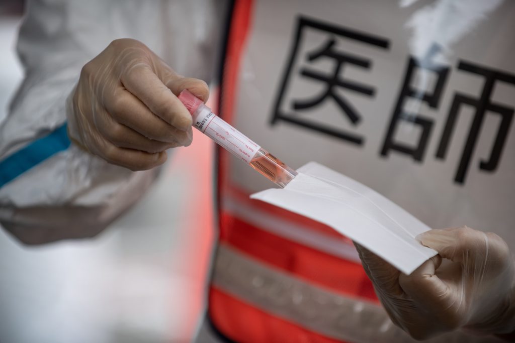 The gene-based technology is used in the vaccine for which clinical trials are set to start in Japan on Tuesday. (AFP)