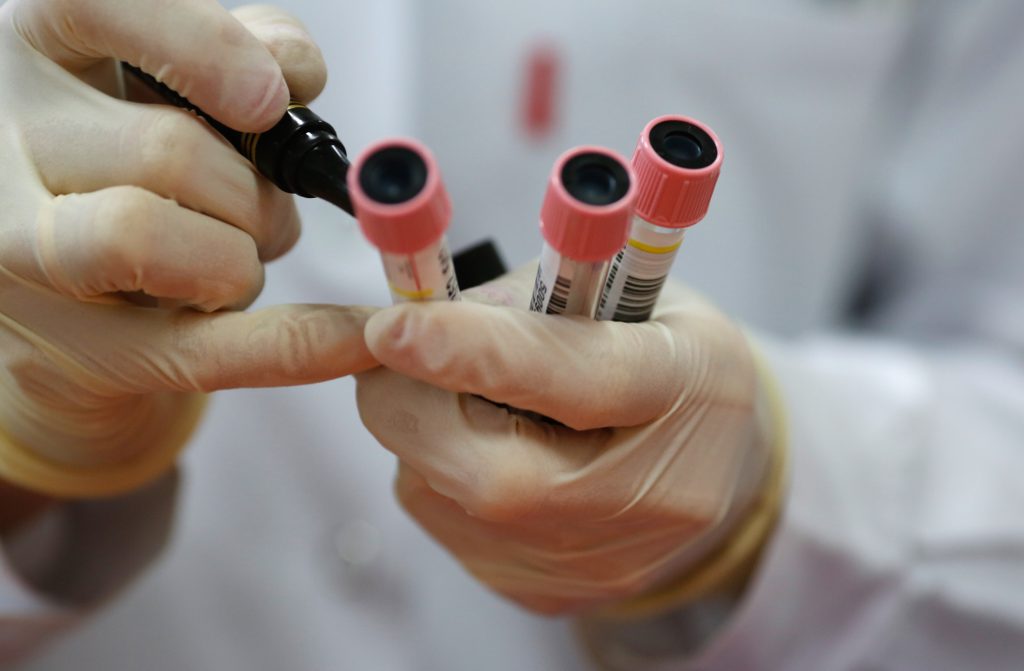 Samples from serological tests, also called antibody tests. (AFP)