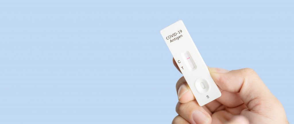 The government aims to promote COVID-19 self-testing and advise patients with mild symptoms to stay at home. (Shutterstock)