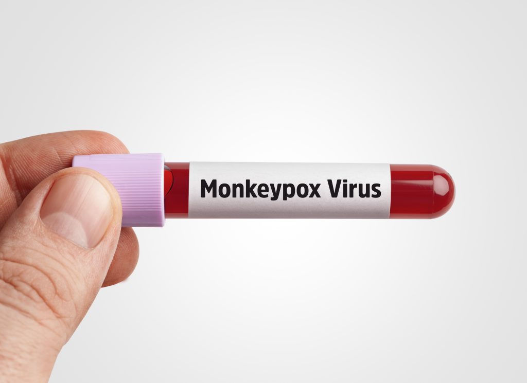 More than 16 million monkeypox cases have been confirmed in 75 countries and regions this year, according to Tedros. (Shutterstock)