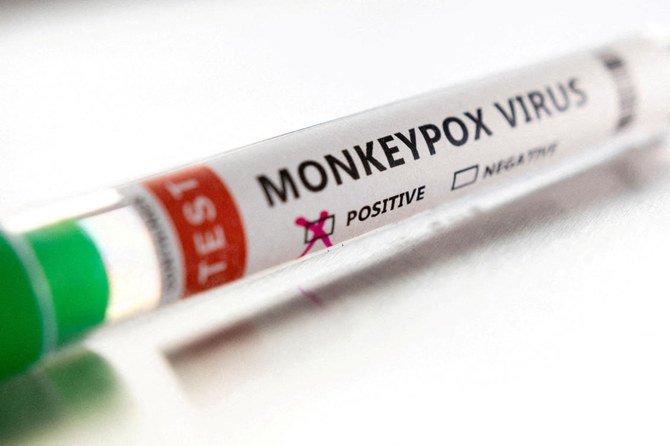 Japan’s government on Friday confirmed its third case of monkeypox. (Reuters)