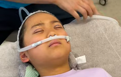 Nine-year old Japanese patient, Micchi, while getting the “double eyelid” operation. (Twitter/元祖整形ママ)