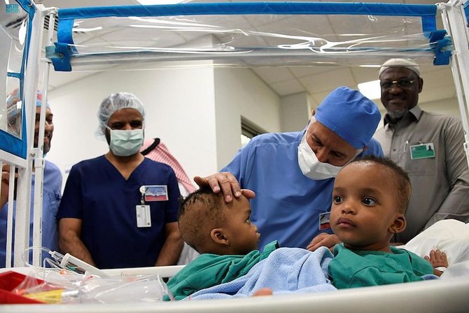 Conjoined twins Hassana and Hassina, who were born in Kaduna, Nigeria on January 12 last year share the abdomen, pelvis, liver, intestines, urinary and reproductive system and pelvic bones. (SPA)