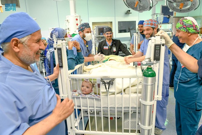 Conjoined twins Hassana and Hassina, who were born in Kaduna, Nigeria on January 12 last year share the abdomen, pelvis, liver, intestines, urinary and reproductive system and pelvic bones. (SPA)