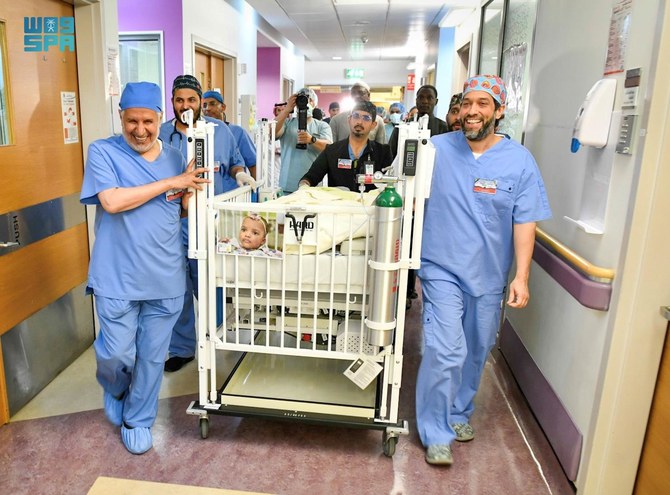 Conjoined twins Hassana and Hassina, who were born in Kaduna, Nigeria on January 12 last year share the abdomen, pelvis, liver, intestines, urinary and reproductive system and pelvic bones. (SPA)