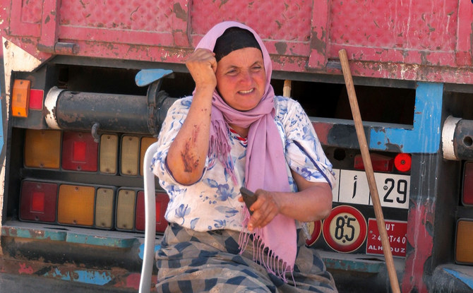 Fatima Boujdig, an earthquake survivor, shows her wounds in Tafeghaghte, a remote village of the High Atlas mountains. (Reuters)