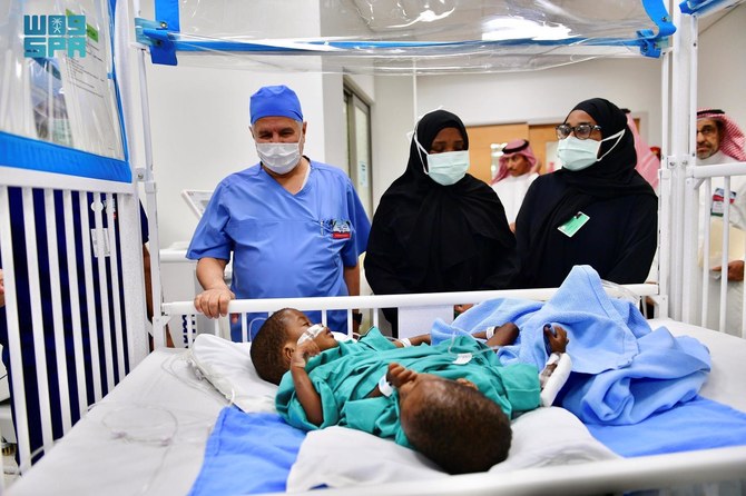 Work begins on separating conjoined Tanzanian twins Hassan and Hussien. (SPA)