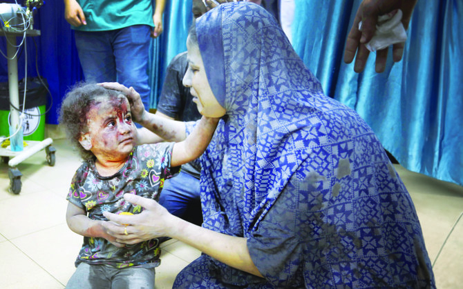 An injured child is brought to the Al-Aqsa Hospital after the Israeli attack. (Getty Images)