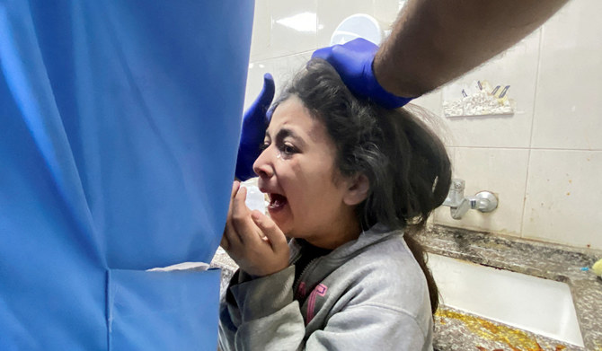 A Palestinian girl wounded in an Israeli strike is assisted, after a temporary truce between Hamas and Israel expired, at Nasser hospital in Khan Younis in the southern Gaza Strip, December 1, 2023. (REUTERS)