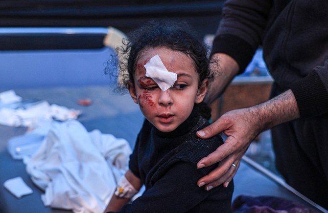A child injured during Israeli bombardment receives treatment at the Kuwait Hospital in Rafah in the southern Gaza Strip on December 20, 2023. (AFP)