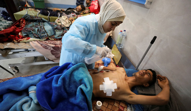 A Palestinian man who was wounded in Israeli fire while waiting for aid, according to health officials, lies on a bed at Al Shifa hospital, amid the ongoing conflict between Israel and Hamas, in Gaza City. (REUTERS file photo)