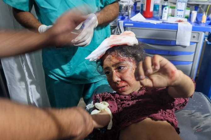 A Palestinian child injured during Israeli bombardment receives treatment at the Kuwait Hospital in Rafah on April 20, 2024. (AFP)