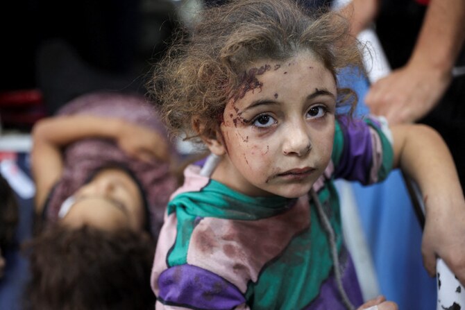 Children who were injured during an Israeli operation in the Jabalia refugee camp in the northern Gaza Strip await treatment at Al-Ahli Arab hospital, also known as the Baptist hospital in Gaza City on October 21, 2024. (AFP)
