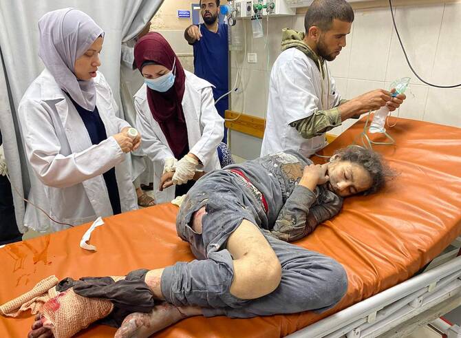 Palestinian doctors care for a girl injured in Israeli strikes, at the Nasser hospital in Khan Yunis in the southern Gaza Strip on Thursday. (AFP)