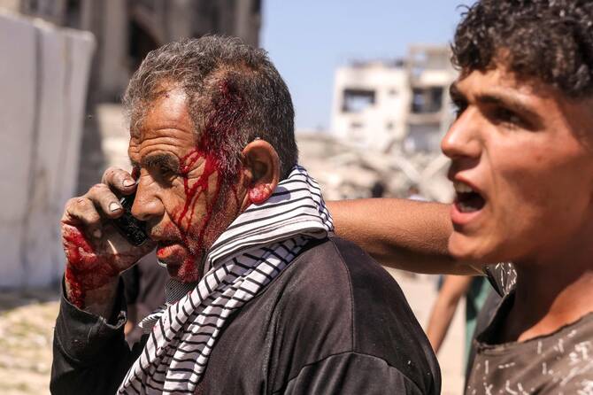 An injured Palestinian man speaks on his phone following an Israeli drone strike in Jabalia, Gaza. (AFP)