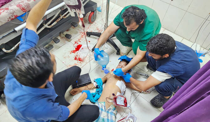 Palestinian medics attend to a child wounded in an Israeli strike on a camp for displaced people near Khan Yunis, at the Nasser Hospital in the southern Gaza Strip city on July 8, 2025. (AFP)