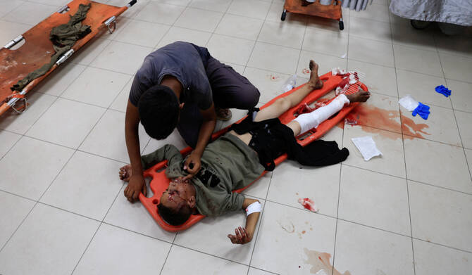 A Palestinian boy lies on a stretcher as he receives treatment after being wounded in morning Israeli strikes on tents sheltering displaced people, according to medics, at Nasser Hospital in Khan Younis, southern Gaza Strip, July 14, 2025. (REUTERS)