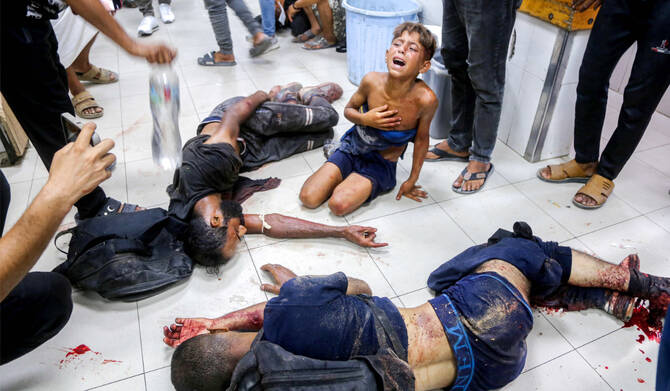An injured boy reacts as he sits on the ground by other men who were all wounded while previously queueing for aid, at Nasser Medical Complex in Khan Yunis in the southern Gaza Strip on July 20, 2025. (AFP)