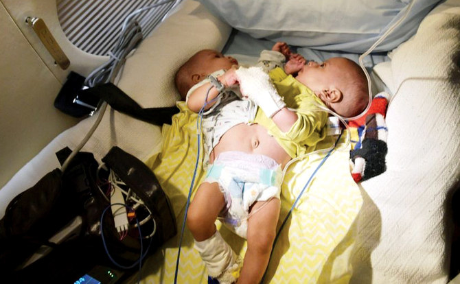 モーリタニアの結合双生児が分離手術のためサウジアラビアに到着 Arab News