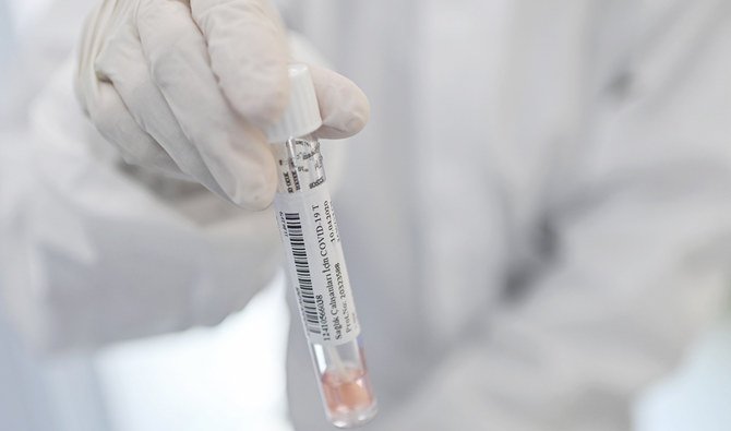 イスタンブールのイスタンブール大学セラパサ医学部病院でCOVID-19検査用の鼻綿棒サンプルを手に持つ医療従事者。(AFP)