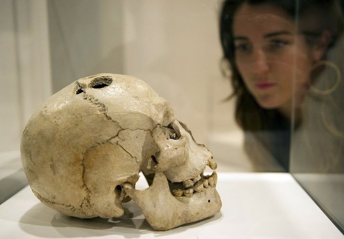 紀元前2200年から2000年の間に作られたジェリコの青銅器時代の頭蓋骨を見る女性（トレフィネーションという古代の外科手術の跡を示している）。(AFP)
