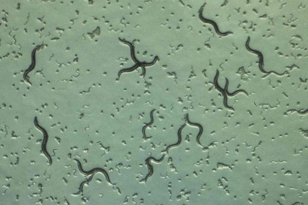 ペトリ皿の中の小さな線虫の顕微鏡写真。東京に本社を置くHIROTSUバイオサイエンスが2021年11月16日に東京で行われた記者会見で示し、初期段階の膵臓がんを発見できる小さな線虫を使ったがん検診方法を紹介した。（資料写真／AFP）