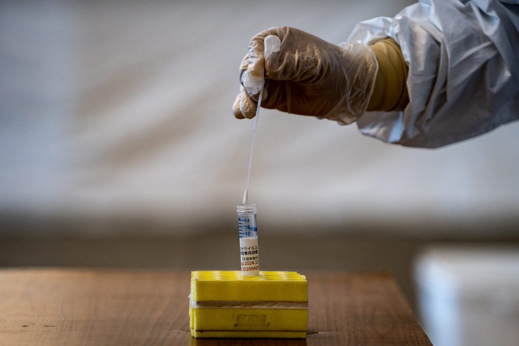 福岡県は２５日、新型コロナウイルスの変異株「オミクロン株」に２０代男性が感染していることが確認されたと発表した。(AFP)
