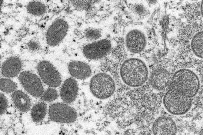 人間の皮膚から得られたサンプル中のサル痘ウイルスの電子顕微鏡写真。左側の楕円形のものが成熟したウイルスで、右側の球形が未成熟ウイルス。（AP）
