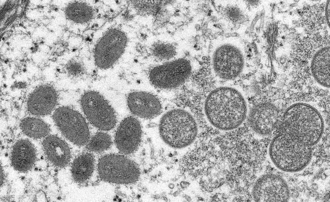 保健予防省は声明の中で、UAE保健当局はウイルスを早期に検出し患者の濃厚接触を追跡するために必要な予防措置を取っていると述べた。   （File/AFP）
