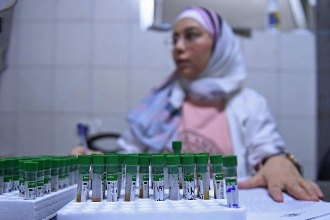 シリア北部アレッポ市の病院で検査技師がコレラのサンプルを検査している。（AFP）