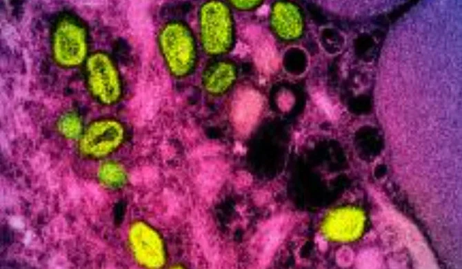 この日付のない画像は、実験室で培養された感染細胞（ピンクと紫）内で見つかったサル痘粒子（緑）のカラー透過型電子顕微鏡写真である（AFP）