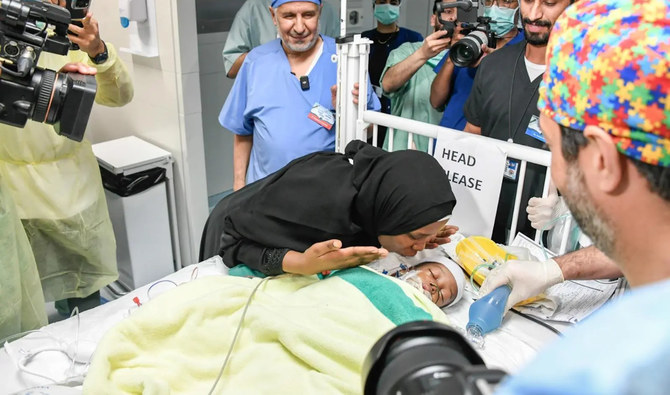 リヤドの国家警備隊省のキング・アブドルアジーズ・メディカルシティにあるキング・アブドゥラー小児専門病院で、医療・手術チームが2歳のハッサンちゃんとフセインちゃんの分離手術を行った。（SPA）