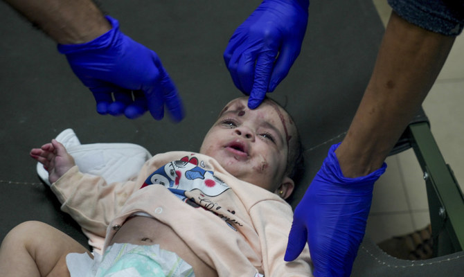 デイル・アルバラの病院で手当てを受ける、イスラエル軍のガザ砲撃で負傷した赤ちゃん。ガザ紛争は、必要最低限の生活必需品の不足をもたらす人道危機を引き起こした。（AP）