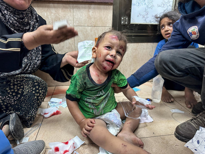 2024年6月8日、ガザ地区中央部でのイスラエル軍の空爆後、アル・アクサ殉教者病院で介助される負傷した子ども。(ロイター)