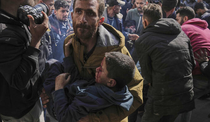 2025年4月12日土曜日、イスラエルの空爆で負傷したパレスチナの子供たちが、ガザ市のバプテスト病院に運び込まれた。(AP)